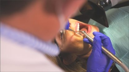 Vanguard Mobile 2.0 - Extraoral Dental Suction for Aerosols - 10337 - Image 3